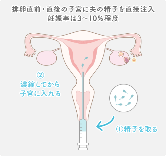 人工 授精 ベスト 販売 タイミング